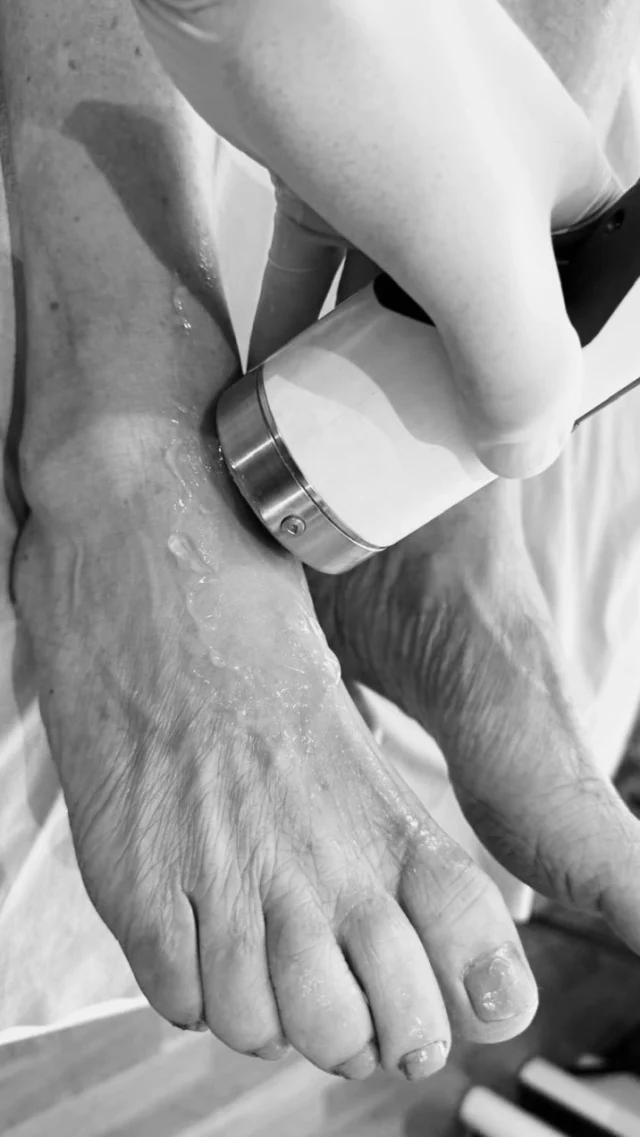 ⚫️ Rückblick: Fußheberschwäche rechts

Der Befund der Patientin:
Die Patientin hatte eine Fußheberschwäche rechts entwickelt. Ihr fehlte insbesondere die Kraft, den Fuß aktiv nach oben zu ziehen.

Behandlung:
Mit der radialen und fokussierten Stoßwellentherapie (ESWT) erfolgte zunächst die gezielte Behandlung des M. tibialis anterior, M. extensor digitorum longus und M. extensor hallucis longus.

Ziel war es, Verklebungen und myofasziale Spannungen zu reduzieren, die Gleitfähigkeit der Sehnen gegenüber den umliegenden Gewebeschichten zu verbessern und dadurch die muskuläre Ansteuerung zu unterstützen.

Ein weiterer Schwerpunkt lag auf dem Muskel-Sehnen-Übergang oberhalb des oberen Sprunggelenks. Hier zeigten sich deutlich schmerzhafte Punkte im Bereich der tiefen Streckmuskulatur, die gezielt mitbehandelt wurden.

Besonders interessant: Ein Schmerzpunkt im Verlauf der für die Großzehenhebung relevanten Muskulatur am Unterschenkel löste einen ausstrahlenden Schmerz bis in die Großzehe aus. Dies spricht für einen funktionellen Zusammenhang zwischen den Beschwerden an der Großzehe und den Strukturen weiter proximal am Unterschenkel.

Ergebnis:
Bereits nach der Behandlung zeigte sich eine Verbesserung von etwa 30–40 %. Die Ansteuerung der Großzehe war jedoch weiterhin eingeschränkt, sodass die Therapie fortgeführt wird. Zur ergänzenden Entlastung der Fußheberschwäche wurde bis zum nächsten Termin ein Tape angelegt.

⚫️ Sie finden mich in der Salzsenderzeile 2 in 83512 Wasserburg am Inn.

Sie haben Fragen zu meinen ganzheitlichen Therapien? Sie haben akute Beschwerden und möchten einen Termin vereinbaren? Ich freue mich auf Ihre Anfrage! · · · IHR ANSPRECHPARTNER Dr. med. Sebastian Sinz Facharzt für Orthopädie und Unfallchirurgie, Sportmedizin, Orthomolekularmedizin

✉️ info@sportmedizin-sinz.de · 📱 +49 160 90179327 · Montag - Freitag: Termine und Notfalltermine nach Vereinbarung

#sportmedizinsinz #ganzheitlichesportmedizin #stoßwellentherapienachsinz

#fußheberschwäche #behandlung