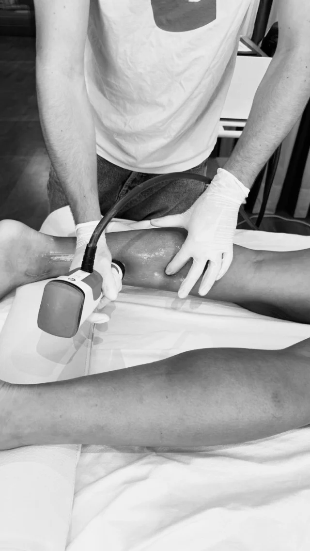 ⚫️ Knieschmerzen seit über einem Jahr – und die Ursache liegt im Fuß?!

Sportlich aktive Patientin mit seit über einem Jahr bestehenden rechtsseitigen Knieschmerzen. In der Vorgeschichte: Weber-C-Fraktur links sowie Arthroskopie des rechten Sprunggelenks mit Mikrofrakturierung.

Ausgangsbefund:
6 kg Belastungsdifferenz – rechts > links, Beckenhochstand links, eingeschränkte Knieextension rechts sowie ein auffälliges Gangbild mit Overcrossing und Rechtsdrift.

Behandlung:
Wir beginnen nicht am Knie, sondern distal am Fuß. Mit radialer und fokussierter Stoßwellentherapie behandeln wir gezielt die auffälligen myofaszialen Strukturen und überprüfen anschließend erneut die gesamte funktionelle Kette.

Der direkte Retest zeigt:
👉 Belastungsverteilung nahezu ausgeglichen
👉 Becken deutlich ausgeglichener
👉 Knie wieder besser durchstreckbar
👉 Rechter Gluteus deutlich weicher – ohne direkte Behandlung

Der Schmerz zeigt uns nicht immer, wo das Problem beginnt.

Distal beginnen. Retesten. Der funktionellen Kette folgen.

Funktion vor Struktur.

⚫️ Sie finden mich in der Salzsenderzeile 2 in 83512 Wasserburg am Inn.

Sie haben Fragen zu meinen ganzheitlichen Therapien? Sie haben akute Beschwerden und möchten einen Termin vereinbaren? Ich freue mich auf Ihre Anfrage! · · · IHR ANSPRECHPARTNER Dr. med. Sebastian Sinz Facharzt für Orthopädie und Unfallchirurgie, Sportmedizin, Orthomolekularmedizin

✉️ info@sportmedizin-sinz.de · 📱 +49 160 90179327 · Montag - Freitag: Termine und Notfalltermine nach Vereinbarung

#sportmedizinsinz #ganzheitlichesportmedizin #stoßwellentherapienachsinz

#fußheberschwäche #behandlung